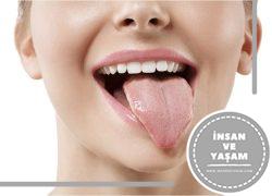 Sarı dil rengi nedir? Dil sarılığı neye yol açar
