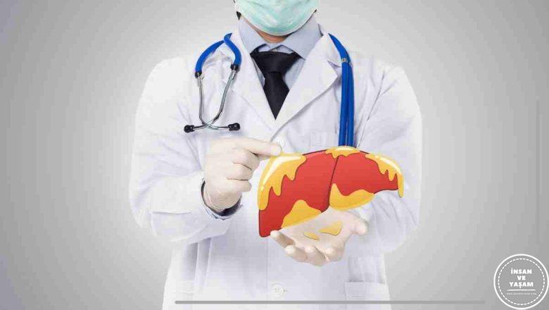  Karaciğer Yağlanması Neden Olur? Nasıl Geçer? Tedavisi Nasıl Yapılır