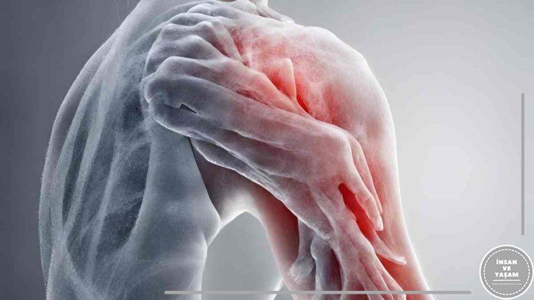 Donuk Omuz (Adhesive Kapsülit) Nedir ve Nasıl Tedavi Edilir?