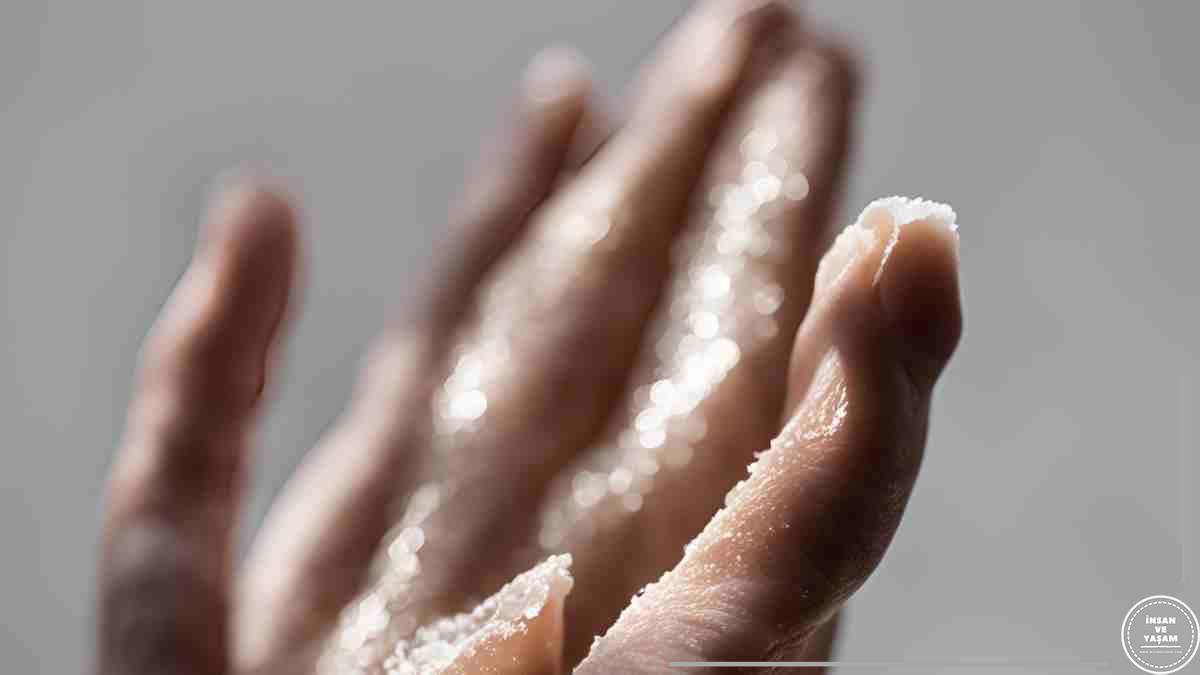 Balık Pulu Hastalığı